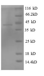 Human Tubulin-specific chaperone C (TBCC) Recombinant Protein, Homo sapiens (Human), E.coli, N-terminal 6xHis-tagged, 43.0 kDa, purity >≥ 90% as determined by SDS-PAGE.