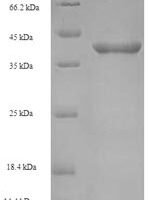 Listeria monocytogenes serotype 4b Internalin-A (inlA), partial Recombinant Protein, N-His-SUMO - BioCrest Sci