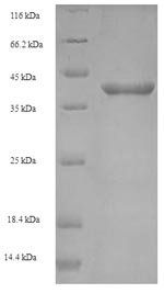 Listeria monocytogenes serotype 4b Internalin-A (inlA), partial Recombinant Protein, N-His-SUMO, Listeria monocytogenes serotype 4b (strain F2365), E.coli, N-terminal 6xHis-SUMO-tagged, 38.5 kDa, purity >≥ 90% as determined by SDS-PAGE.