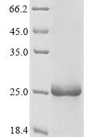 Human Cytidine deaminase (CDA) Recombinant Protein, N-10His/C-Myc - BioCrest Sci