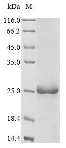 Human Cytidine deaminase (CDA) Recombinant Protein, N-10His/C-Myc, Homo sapiens (Human), E.coli, N-terminal 10xHis-tagged and C-terminal Myc-tagged, 23.6 kDa, purity >≥ 85% as determined by SDS-PAGE.