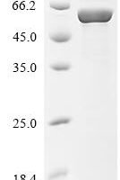 Human T cell receptor beta constant 1 (TRBC1), partial,Biotinylated Recombinant Protein - BioCrest Sci