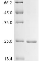 Escherichia coli Methylated-DNA--protein-cysteine methyltransferase (ogt) Recombinant Protein - BioCrest Sci