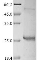 Vaccinia virus Entry-fusion complex associated protein OPG095 (OPG099), partial Recombinant Protein - BioCrest Sci
