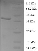 Human Forkhead box protein P1 (FOXP1), partial Recombinant Protein - BioCrest Sci