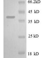 Escherichia coli 30S ribosomal protein S13 (rpsM) Recombinant Protein - BioCrest Sci