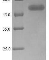 Human Natural killer cell receptor 2B4 (CD244), partial Recombinant Protein, N-GST - BioCrest Sci