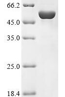 Human Potassium-transporting ATPase alpha chain 1 (ATP4A), partial Recombinant Protein - BioCrest Sci
