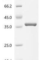 Escherichia coli Formamidopyrimidine-DNA glycosylase (mutM) Recombinant Protein - BioCrest Sci