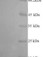 Human Inactive N-acetylated-alpha-linked acidic dipeptidase-like protein 2 (NAALADL2), partial Recombinant Protein - BioCrest Sci