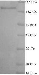 Human Inactive N-acetylated-alpha-linked acidic dipeptidase-like protein 2 (NAALADL2), partial Recombinant Protein, Homo sapiens (Human), Yeast, N-terminal 6xHis-tagged, 74.6 kDa, purity >≥ 90% as determined by SDS-PAGE.