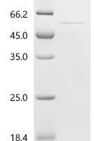 Mouse Plasminogen activator inhibitor 2, macrophage (Serpinb2) Recombinant Protein - BioCrest Sci