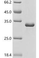 Human Testis-expressed protein 101(TEX101) Recombinant Protein - BioCrest Sci