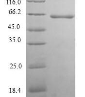 Human Thioredoxin domain-containing protein 5 (TXNDC5) Recombinant Protein, N-GST - BioCrest Sci