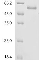 Human Ephrin-A5 (EFNA5), partial Recombinant Protein - BioCrest Sci