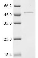 Human Poly [ADP-ribose] polymerase tankyrase-2 (TNKS2), partial Recombinant Protein - BioCrest Sci