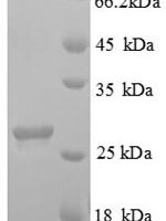 Arabidopsis thaliana Abscisic acid receptor PYL1 (PYL1), partial Recombinant Protein - BioCrest Sci
