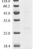 Bovine Beta-defensin 5 (DEFB5) Recombinant Protein, C-His - BioCrest Sci