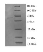 Human LIM domain-containing protein 2 (LIMD2) Recombinant Protein - BioCrest Sci