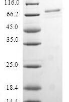 Human mRNA export factor (RAE1) Recombinant Protein - BioCrest Sci