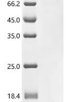 Human Kinesin-like protein KIF22 (KIF22) Recombinant Protein - BioCrest Sci