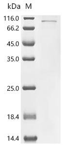 Human Kinesin-like protein KIF22 (KIF22) Recombinant Protein, Homo sapiens (Human), Homo sapiens (Human), C-terminal 6xHis-tagged, 76 kDa, purity >≥ 90% as determined by SDS-PAGE.