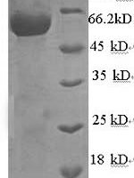 Rabies virus Nucleoprotein (N) Recombinant Protein, N-His, aa 1–450, Yeast - BioCrest Sci