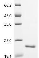 Pseudomonas aeruginosa Large ribosomal subunit protein bL12 (rplL) Recombinant Protein - BioCrest Sci
