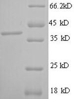 Human Mast cell carboxypeptidase A (CPA3) Recombinant Protein, N-His, aa 110–417, E.coli - BioCrest Sci