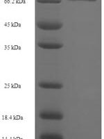 Human Diphthamide biosynthesis protein 2 (DPH2) Recombinant Protein - BioCrest Sci
