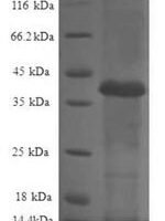 Human 60S ribosomal protein L36a-like (RPL36AL) Recombinant Protein - BioCrest Sci