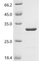 Human Fibroblast growth factor 10 (FGF10), partial Recombinant Protein, C-His - BioCrest Sci