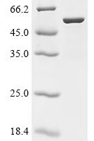 Hypsibius exemplaris Cytosolic-abundant heat soluble protein 89226 (CAHS 89226) Recombinant Protein - BioCrest Sci