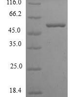 Human Ketohexokinase (KHK) Recombinant Protein - BioCrest Sci