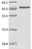 Mouse Sushi, von Willebrand factor type A, EGF and pentraxin domain-containing protein 1 (Svep1), partial Recombinant Protein, C-hFc1 - BioCrest Sci