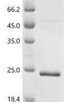 Human Lymphocyte antigen 6K (LY6K) Recombinant Protein, N-His - BioCrest Sci