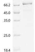 Mouse Na (+)/H (+) exchange regulatory cofactor NHE-RF3 (Pdzk1) Recombinant Protein - BioCrest Sci