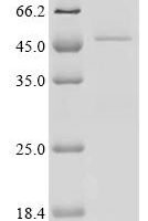 Human Transforming growth factor beta regulator 1 (TBRG1) Recombinant Protein, C-His, aa 1–411, Yeast - BioCrest Sci