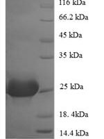Human Parvalbumin alpha (PVALB) Recombinant Protein - BioCrest Sci