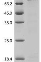 Human Platelet glycoprotein Ib alpha chain (GP1BA), partial Recombinant Protein, N-His, aa 17–531, E.coli - BioCrest Sci