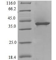 Colwellia psychrerythraea DNA polymerase IV (dinB) Recombinant Protein, NO - BioCrest Sci