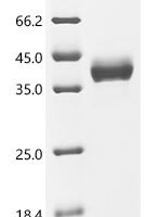 Human Collagen alpha-1 (I) chain (COL1A1), partial Recombinant Protein - BioCrest Sci
