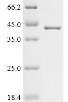 African swine fever virus B646L (p72), partial Recombinant Protein - BioCrest Sci