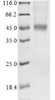 Human Fibroblast growth factor receptor 1 (FGFR1), partial Recombinant Protein, N-His - BioCrest Sci