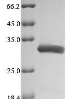 Human Transcription factor p65 (RELA), partial Recombinant Protein, N-His - BioCrest Sci