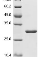 Mouse Apoptosis-associated speck-like protein containing a CARD (Pycard) Recombinant Protein, C-His - BioCrest Sci