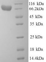 Human Alpha-L-iduronidase (IDUA) Recombinant Protein - BioCrest Sci