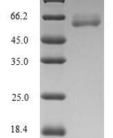 Human Arginase-2, mitochondrial (ARG2) Recombinant Protein - BioCrest Sci