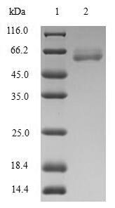 Human Arginase-2, mitochondrial (ARG2) Recombinant Protein, Homo sapiens (Human), E.coli, N-terminal GST-tagged, 63.1 kDa, purity >≥ 90% as determined by SDS-PAGE.