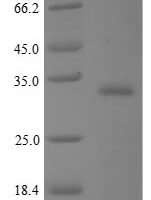 Human BPI fold-containing family A member 2 (BPIFA2) Recombinant Protein, No - BioCrest Sci